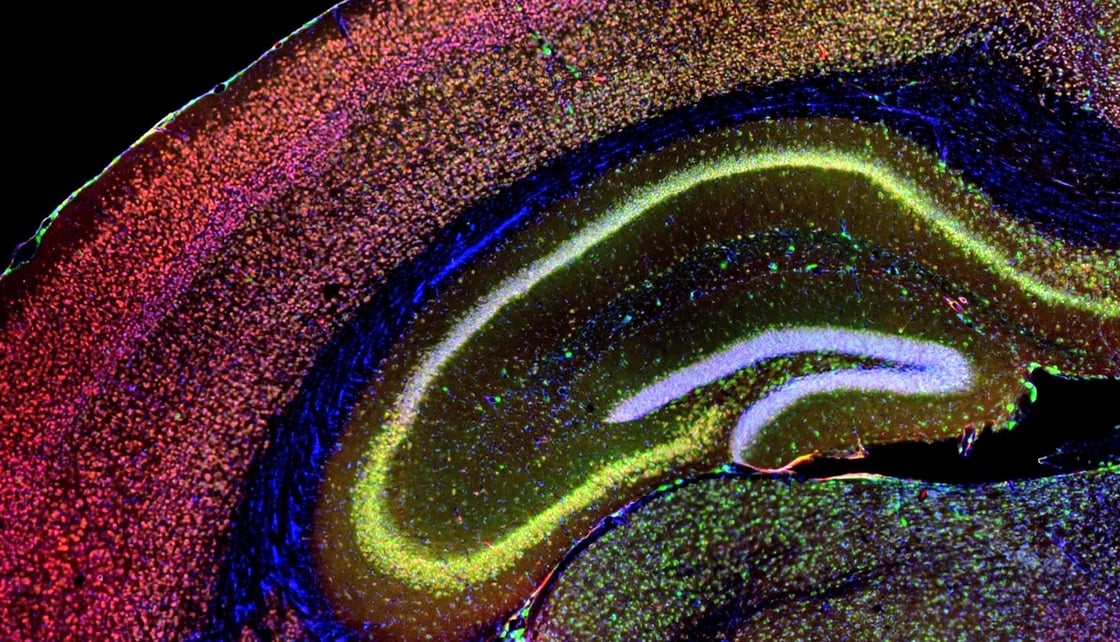 Magazine Highlights: June B 2025 [#17] 2