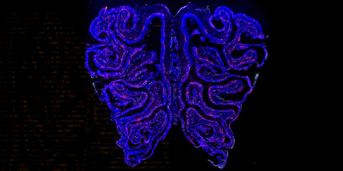 Fluorescent microscopy image showing the tissue lining the inside of a mouse's nose, with different cell types labeled either blue, green, or magenta.
